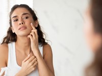 Limpieza profunda: el primer paso para prevenir el acné